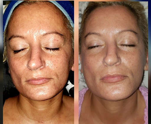 Positive Transformation - Visual