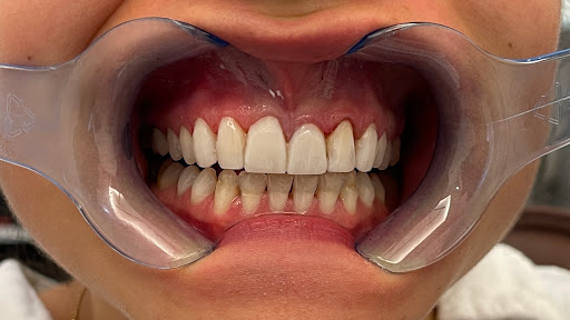 Senova Dental Studios - Thumbnail