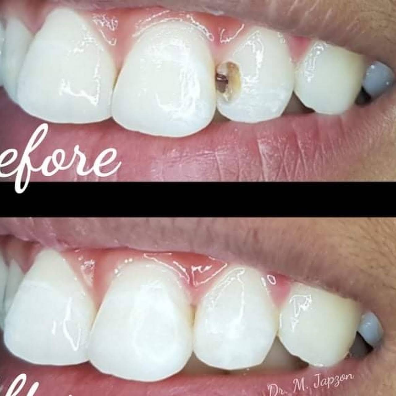 DRMJ ORAL CARE HAVEN Dental Clinic in Mandaluyong. We specialize in