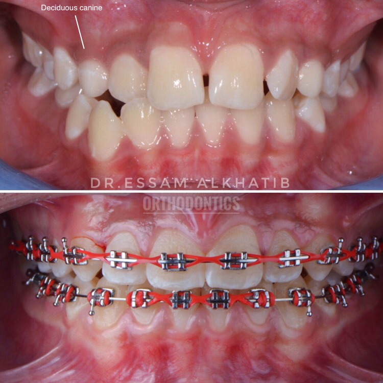 عيادة تقويم الفكين والاسنان د خالد عجيب Dr.khaled Ajeeb orthodontist - صورة 3