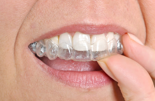 Cabinet d'orthodontie du Dr Olivier Tordjmann - Thumbnail