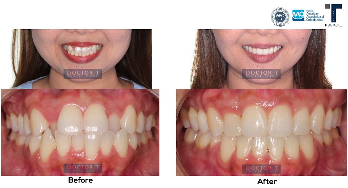 Doctor T Dental Clinic จัดฟัน เฉพาะทางจากอเมริกา American Board Certified — exterior