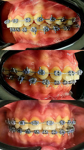 COE Clínica Dental Ocuiltzapotlan - Thumbnail