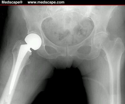 Photos of Orthopaedi & Traumatologi Spesialis Bedah Tulang Dr. Idrus,m.ked.sp.ot