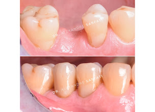 Photo n°12 de Docteur Alexandre Sarfati à Paris (Dentiste)