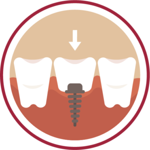 Dunes Periodontics and Implant Dentistry - Thumbnail
