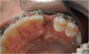 Photo n°18 de Duong Rodolph à Antony (Urgences dentaires)