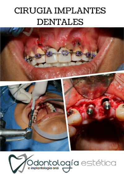 Photos of Odontolog&iacute;a Estetica e Implantologia Oral