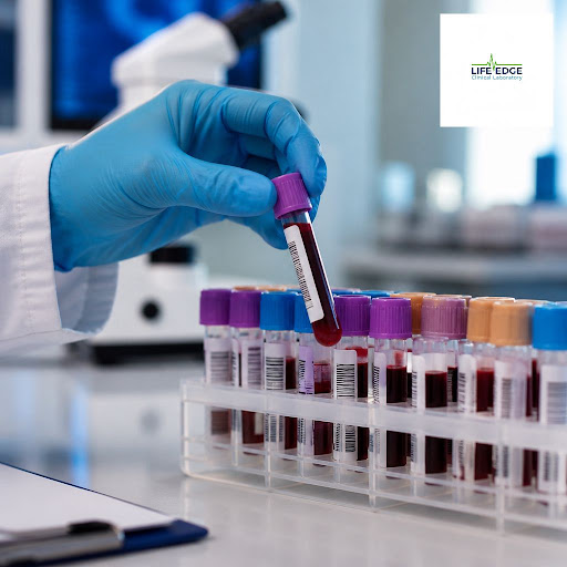 Need urgent lab reports without compromising accuracy? At Life Edge Clinical Laboratory in Jadeed… post image