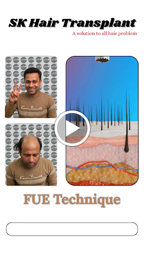 Looking for effective hair treatments? SK Hair Transplant Clinic in Sector 44, Noida NCR, offers…