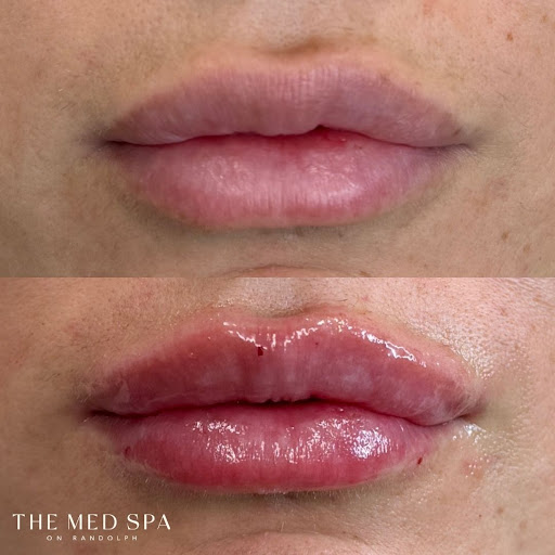 The Med Spa on Randolph