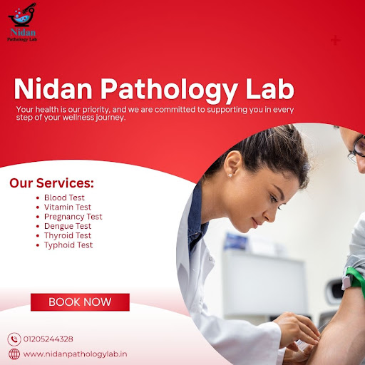 Your health, our priority — precise lab testing you can rely on post image