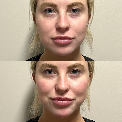 SHarper Surgery, MedSpa + Salt Lounge Fishers