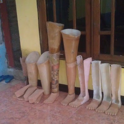 Photos of Bengkel Kaki Palsu