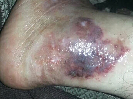 Cured within 14 days  (Dr Soumya Dey's Clinic desk)  post image