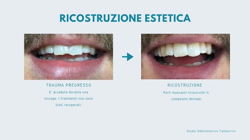 Studio Odontoiatrico Tamburrini Gallery - Italy