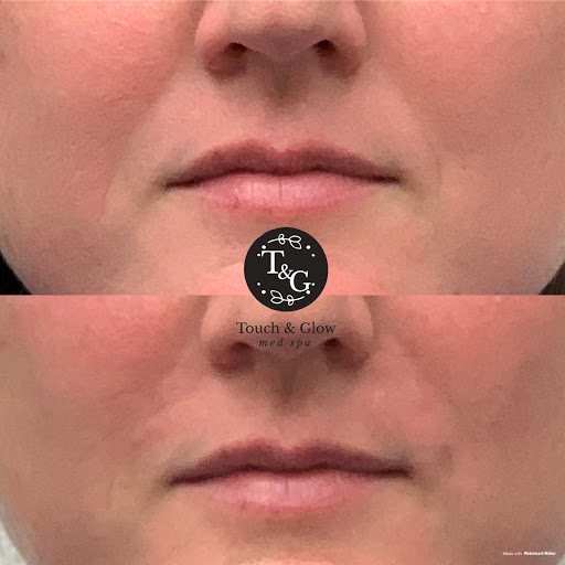 Touch and Glow Med Spa