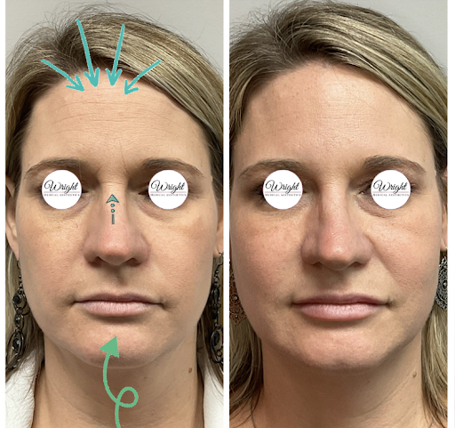 Wright Medical Aesthetics - Thumbnail