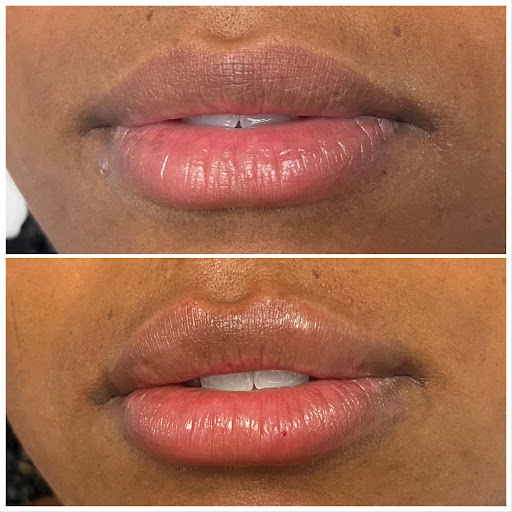 About Face Wellness & Medical Spa