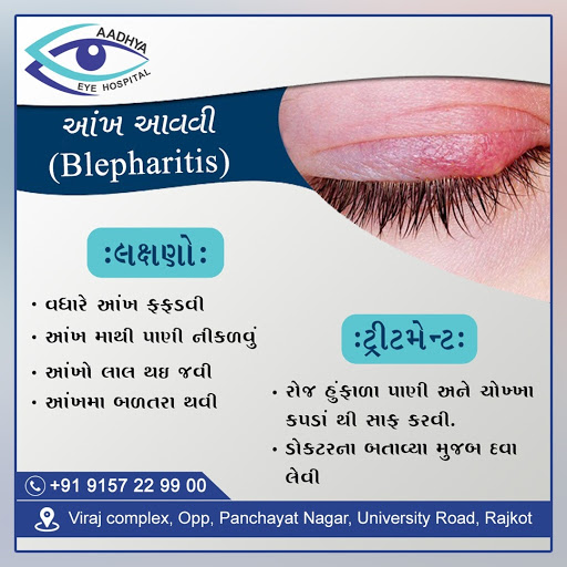 આંખ આવવી એ એક સામાન્ય રોગ છે post image