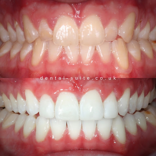 The Dental Suite - Loughborough