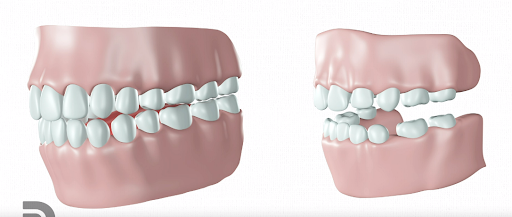 Kaceli Dental Aesthetics - Thumbnail