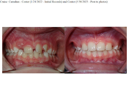Patritto Orthodontics - Thumbnail