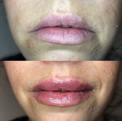 Aesthetic Laser & Skin Care