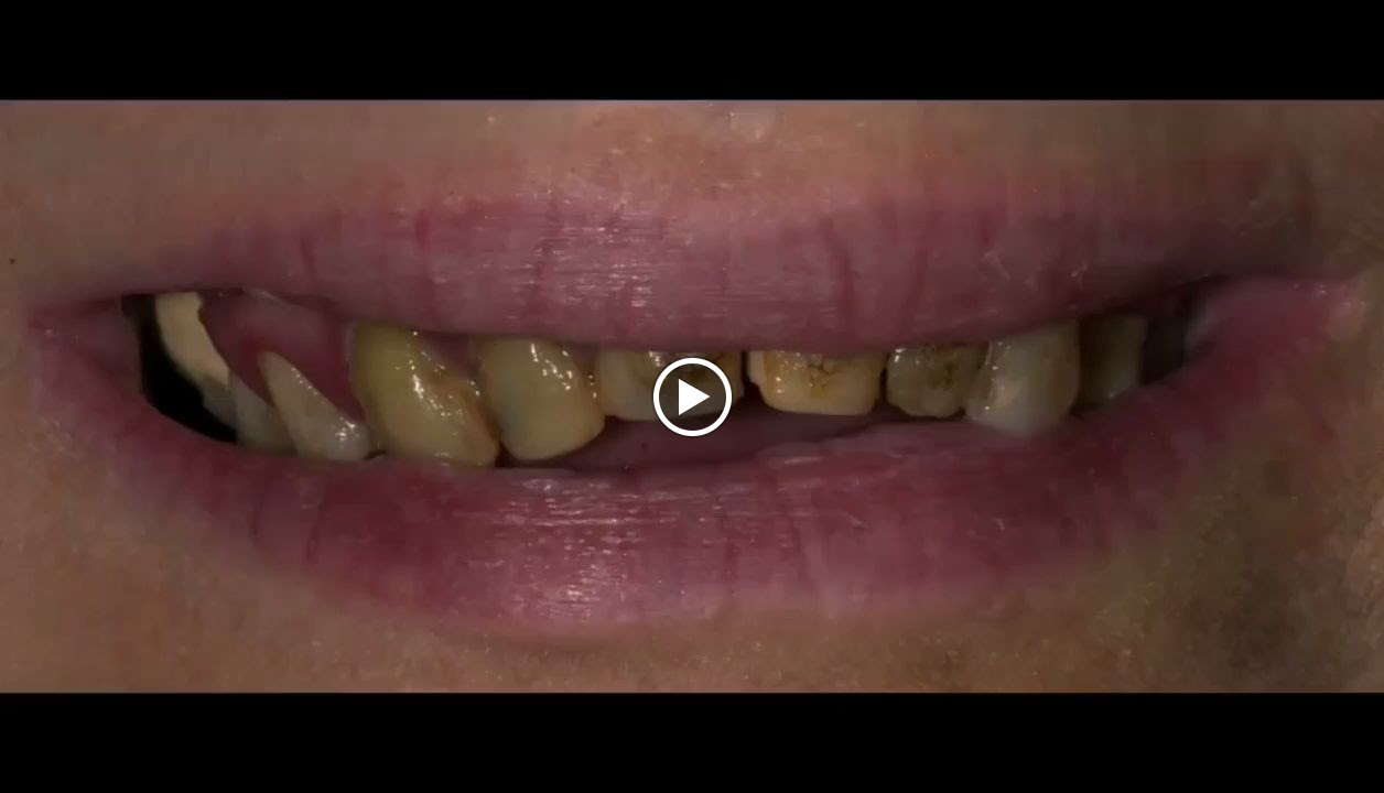 عيادات الدكتور نزار إبراهيم غلام لطب وتقويم الأسنان - صورة 2