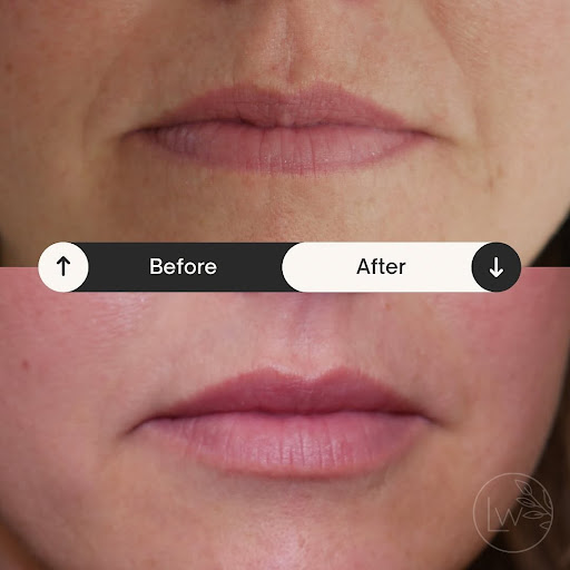LiveWell Medical Aesthetics