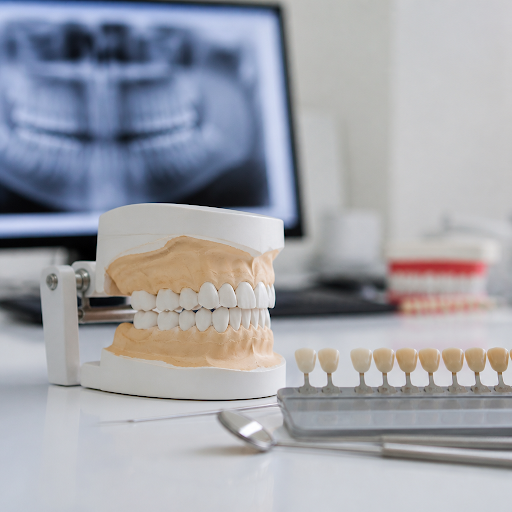 If you have multiple damaged, missing, or worn-out teeth, full mouth rehabilitation can completel… post image