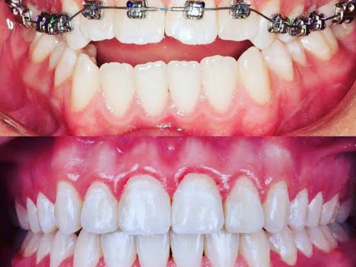 Best dental care clinic in Kankarbagh, Patna.