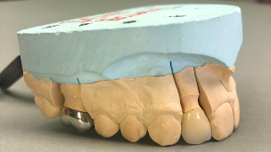 Photo n°1 de Laboratoire Florian prothésiste Dentaire à Vitry-sur-Seine (Laboratoire dentaire)