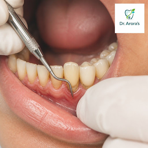 Struggling with bleeding gums, bad breath, or loose teeth? Deep gum infection can silently damage… post image