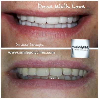 Photos of Smilepolyclinic by Dr. Ziad Dehaybi