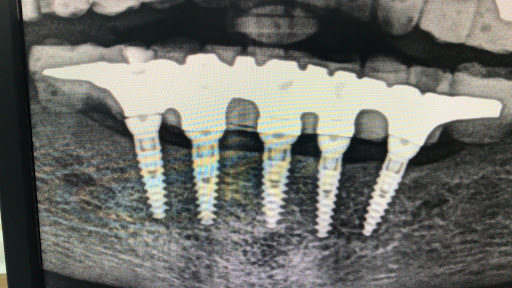 Clinica Dental Limonar - Thumbnail