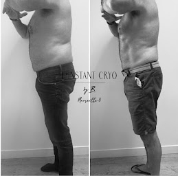 Photo n°9 de L'instant Cryo à Marseille (Centre d'amincissement)