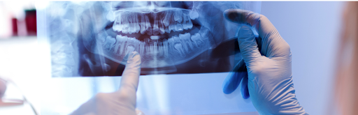 Ballston Lake Family Dental