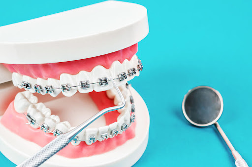 Care starts with a healthy smile that brings confidence in everyday life. Vardan Dental Clinic in… post image