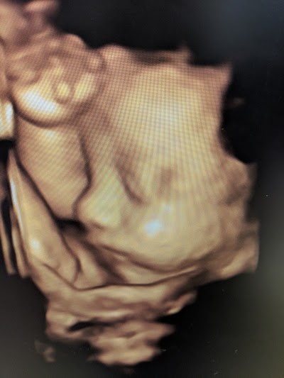 Sweet Baby Face hd 3d 4d ultrasound