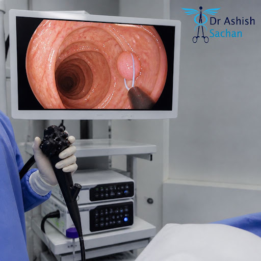 Early detection can save lives. At Dr Ashish Sachan - Shalimar Bagh, New Delhi, we use advanced e… post image