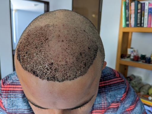 Hair In 1 Day - Thumbnail