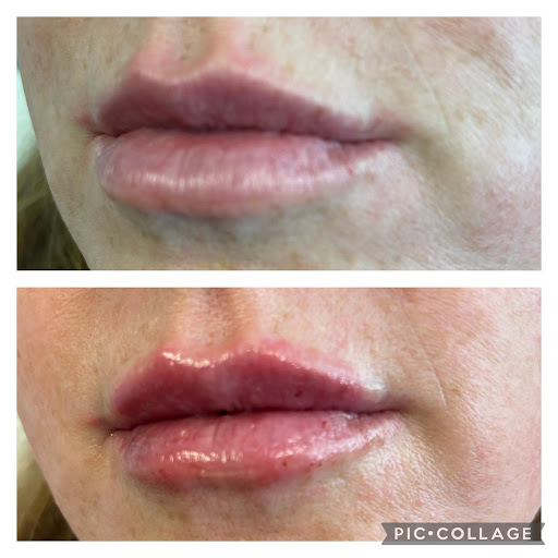 Treasure Valley Aesthetics and Wellness