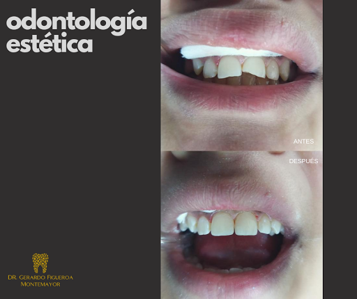 Dr. Gerardo Figueroa Montemayor - Thumbnail