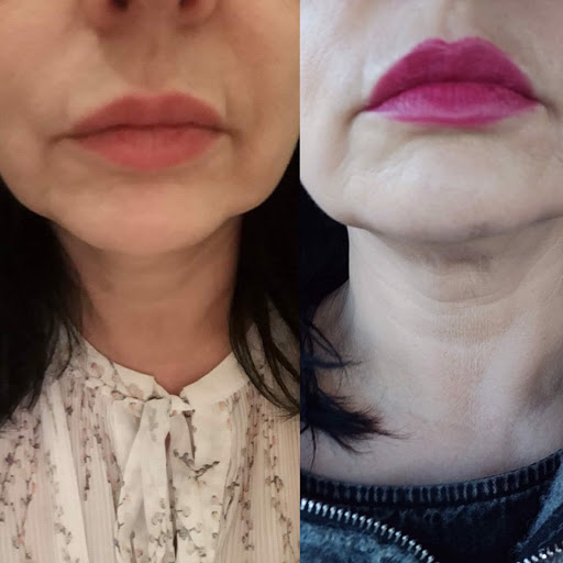 Plasmapod skin clinic Gallery - United Kingdom