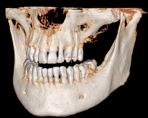 Studio Dentistico Crisetti - Thumbnail