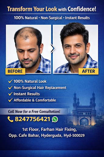 Farhan Hair Fixing is a trusted destination for non-surgical hair replacement in Hyderabad, offer… post image