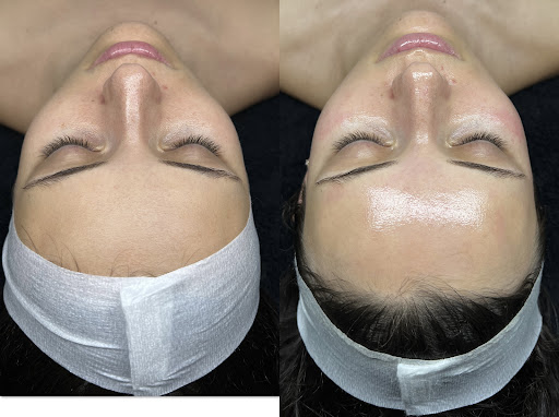 Belle Choses Esthetics Studio - Thumbnail