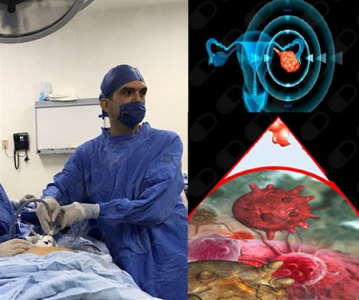 Dr. Ernesto Medina Hernández, Cirujano oncólogo - Thumbnail