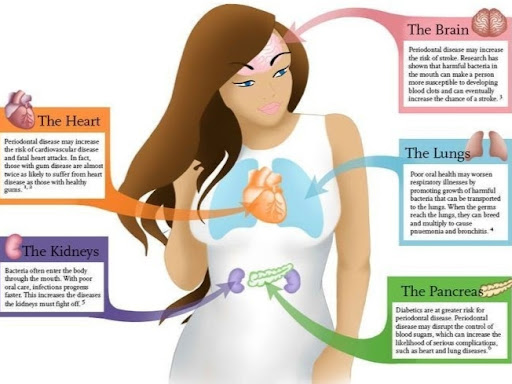 Do you know how oral health affects your genaral health????... post image
